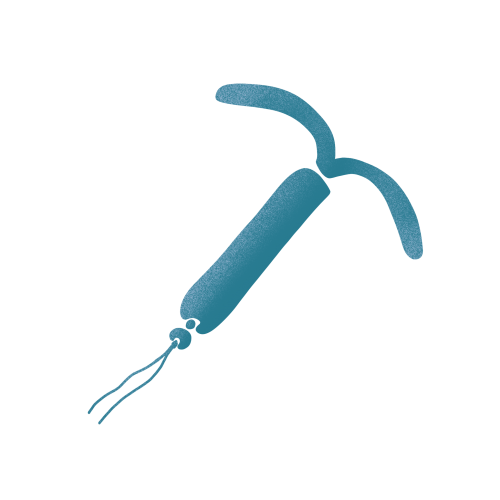 Illustration of the IUS